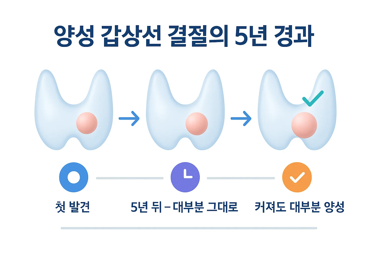 양성 갑상선 결절이 첫 발견, 5년 뒤, 커진 뒤에도 대부분 양성으로 남는 경과를 나타낸 모식도