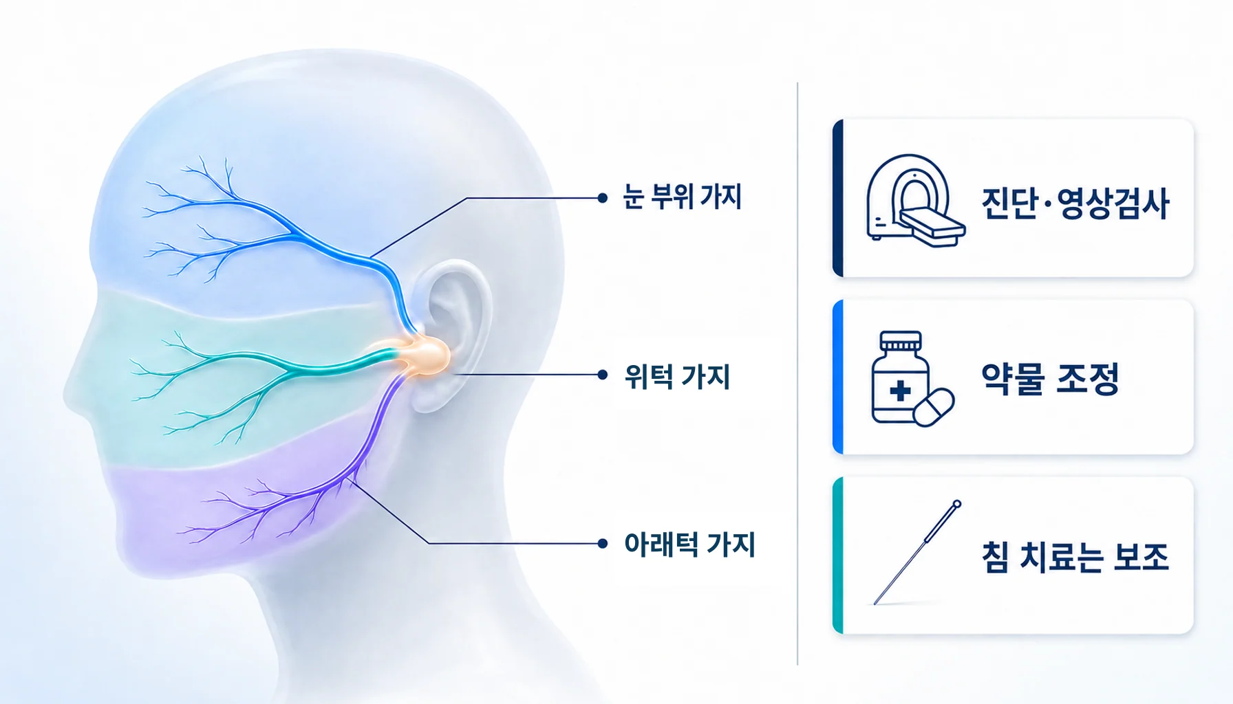 삼차신경 분지별 통증 부위와 진단·약물·침 치료의 역할을 구분한 도식
