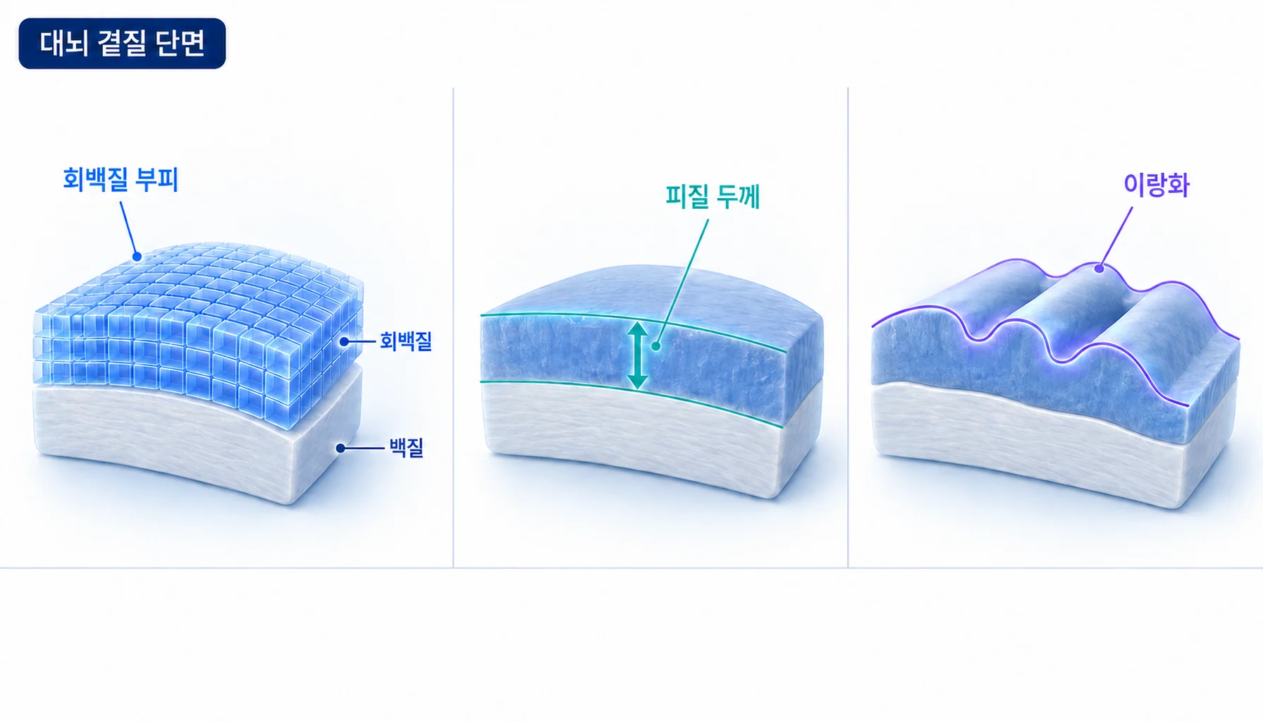회백질 부피·피질 두께·이랑화 세 지표가 각각 무엇을 재는지 비교한 대뇌 피질 단면 도식