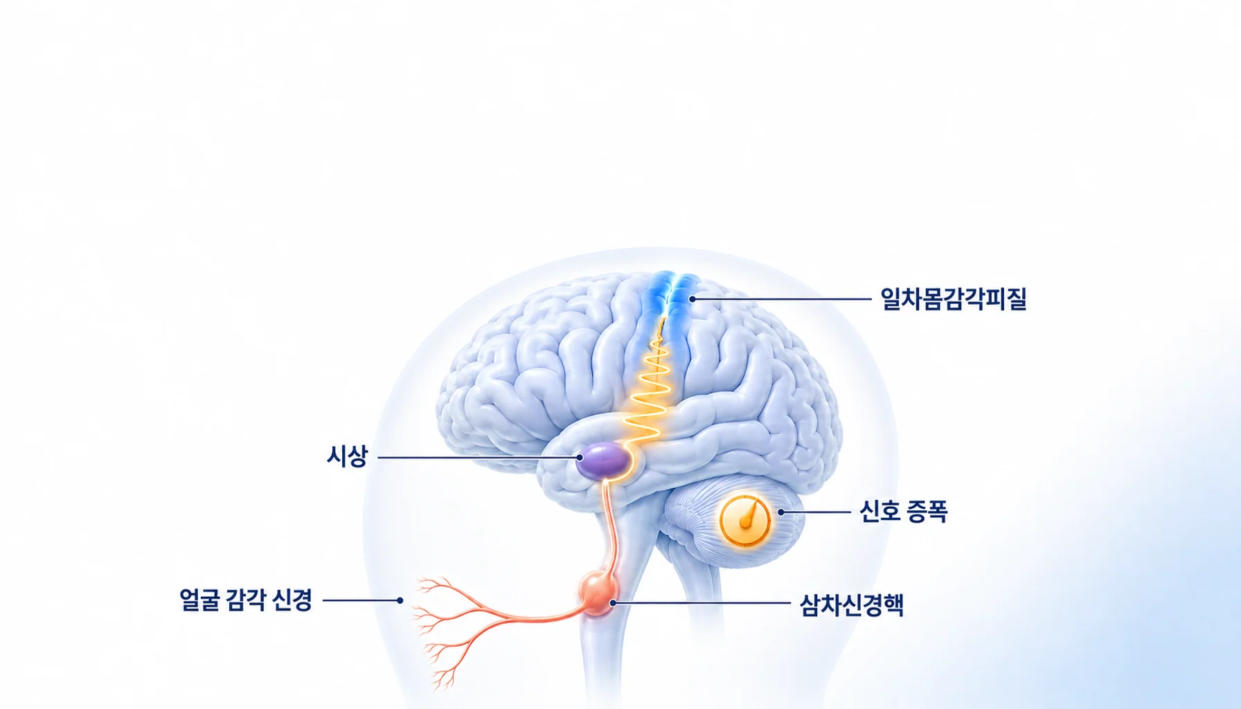 중추감작에서 통증 신호가 증폭되는 경로와 일차몸감각피질의 관계 도식