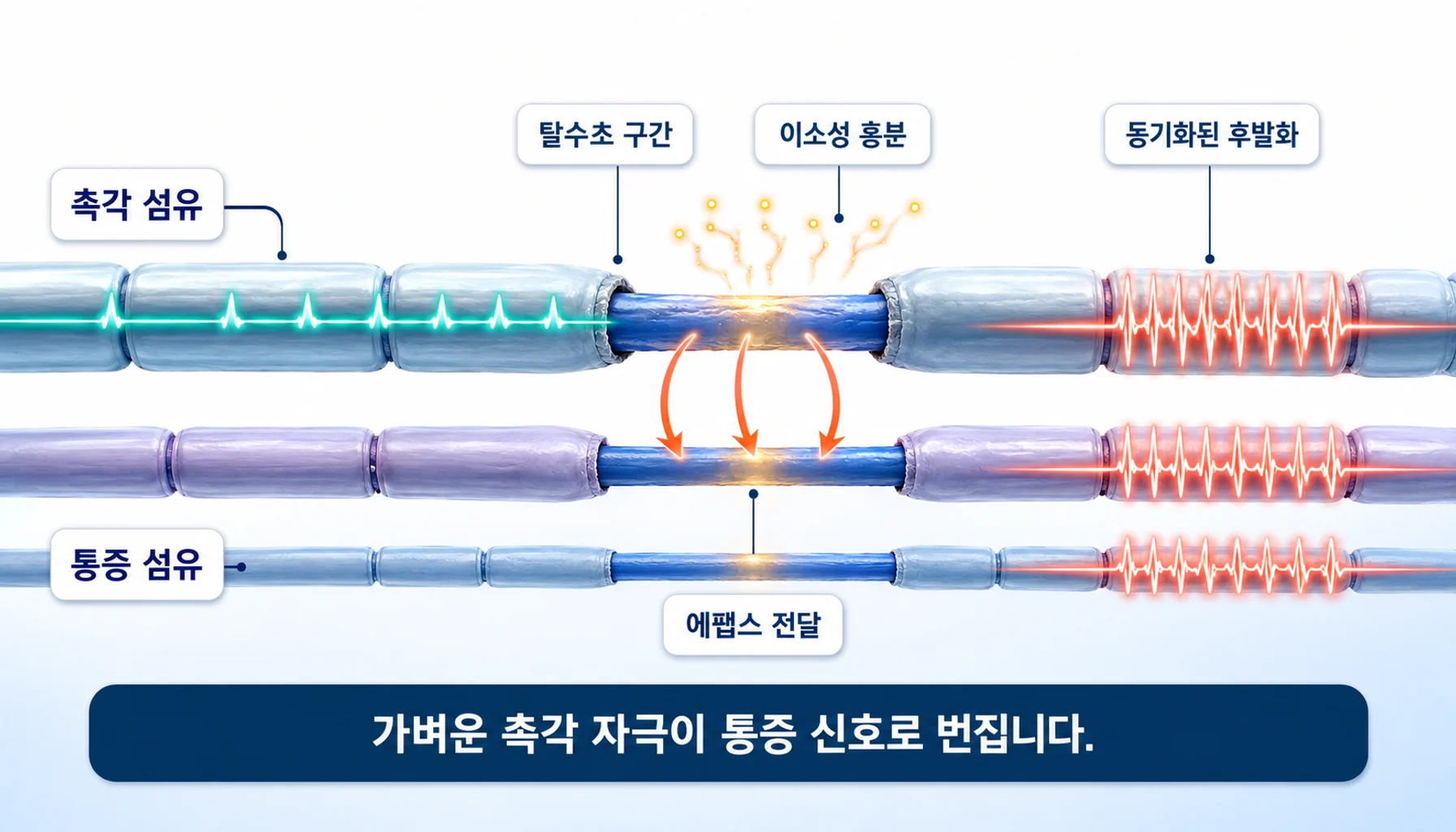 탈수초 구간에서 인접 섬유로 전기가 새어 나가는 에팹스 전달과 동기화된 후발화 도식