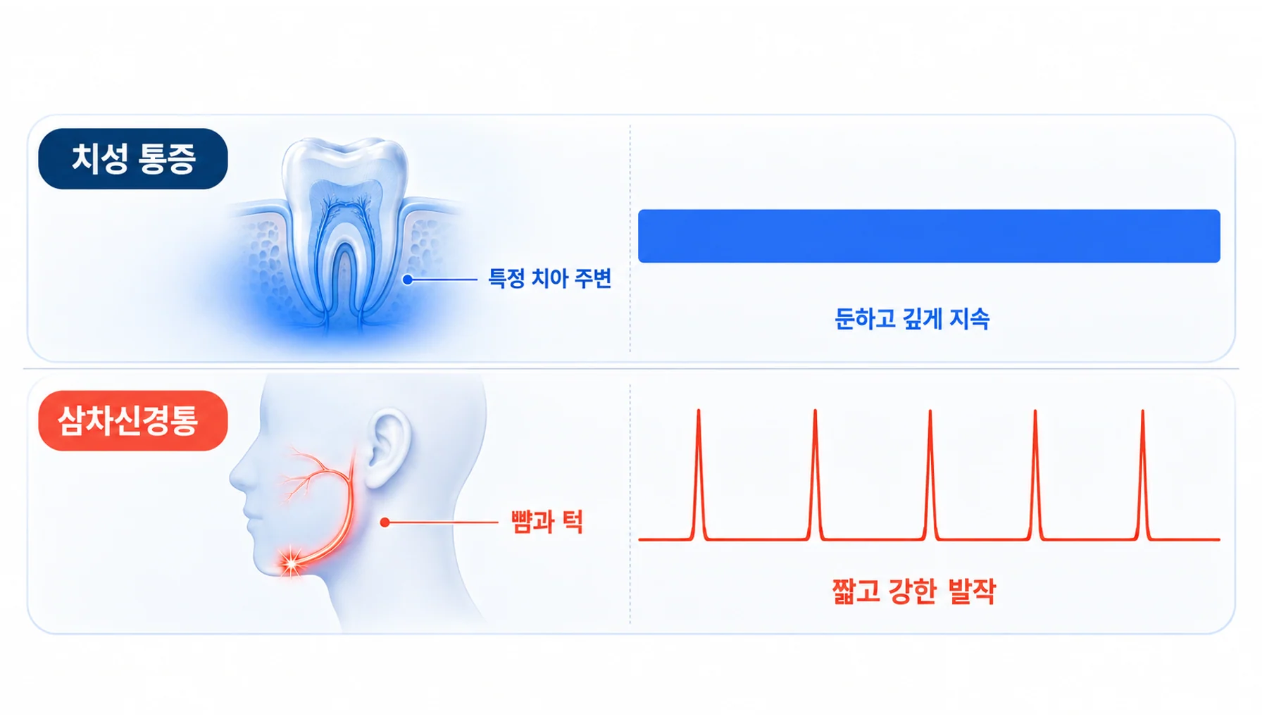 치성 통증과 삼차신경통의 통증 지속 시간과 시작 양상을 비교한 모식도