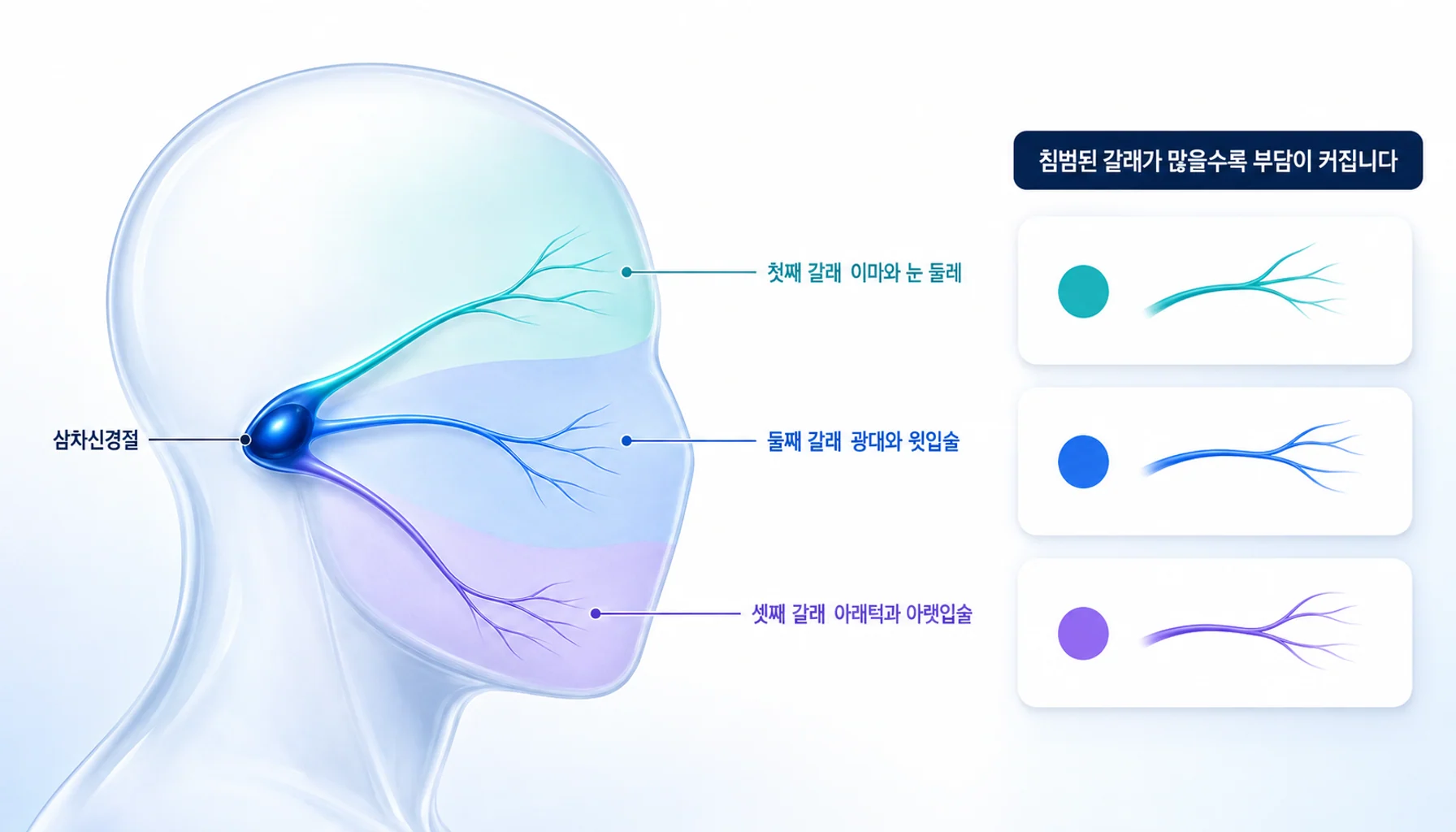 삼차신경의 세 갈래와 각 갈래가 담당하는 얼굴 부위를 보여 주는 해부 모식도