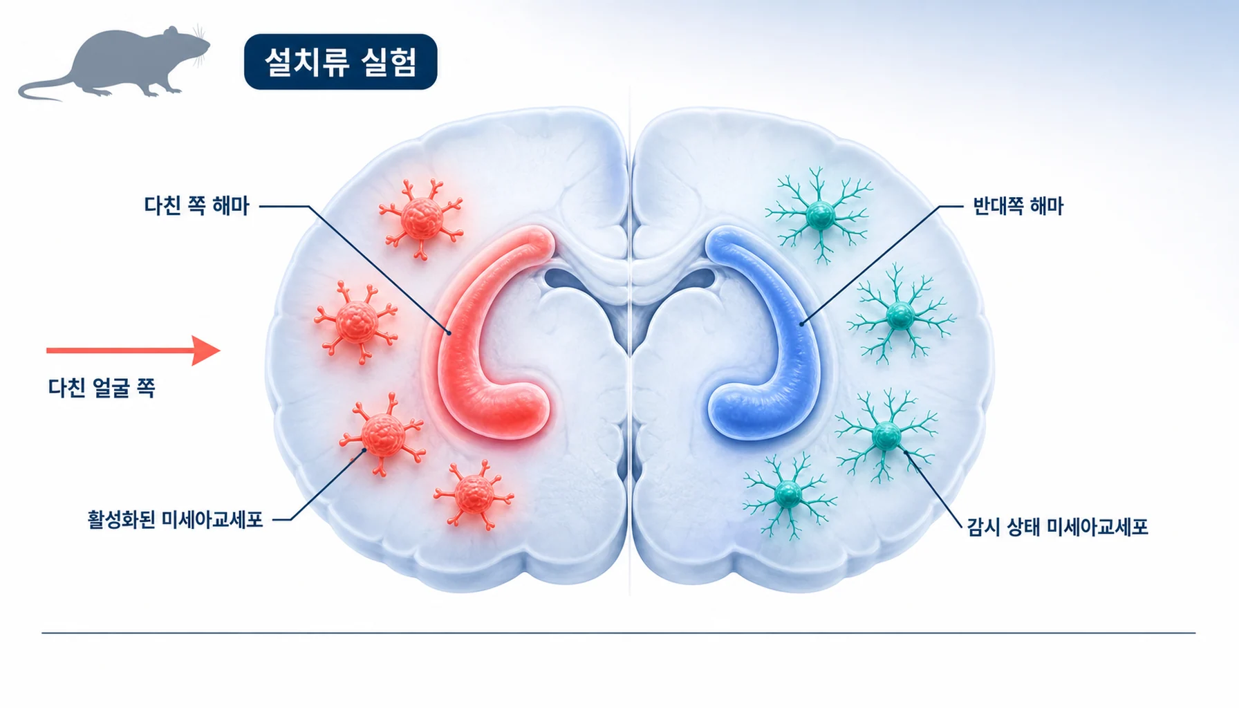 삼차신경통 모델에서 다친 쪽 해마의 미세아교세포만 활성화되는 좌우 비대칭