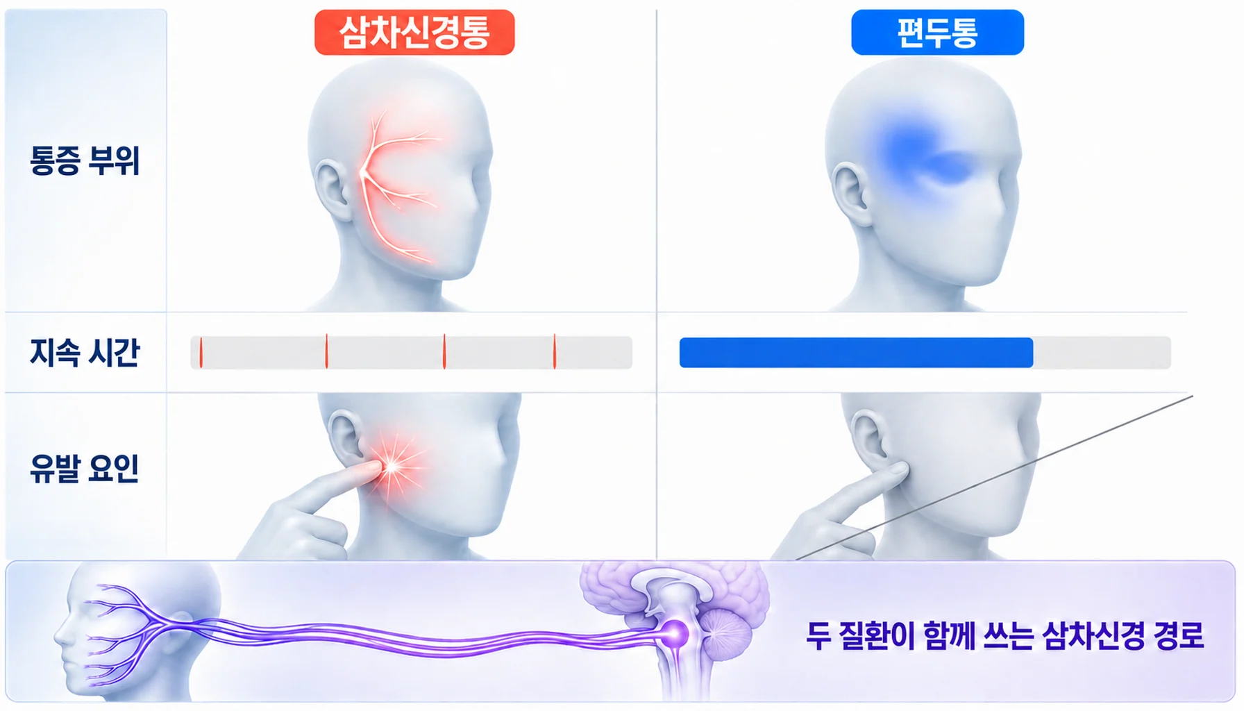 삼차신경 경로를 공유하면서도 서로 다른 양상을 보이는 두 질환의 개념도