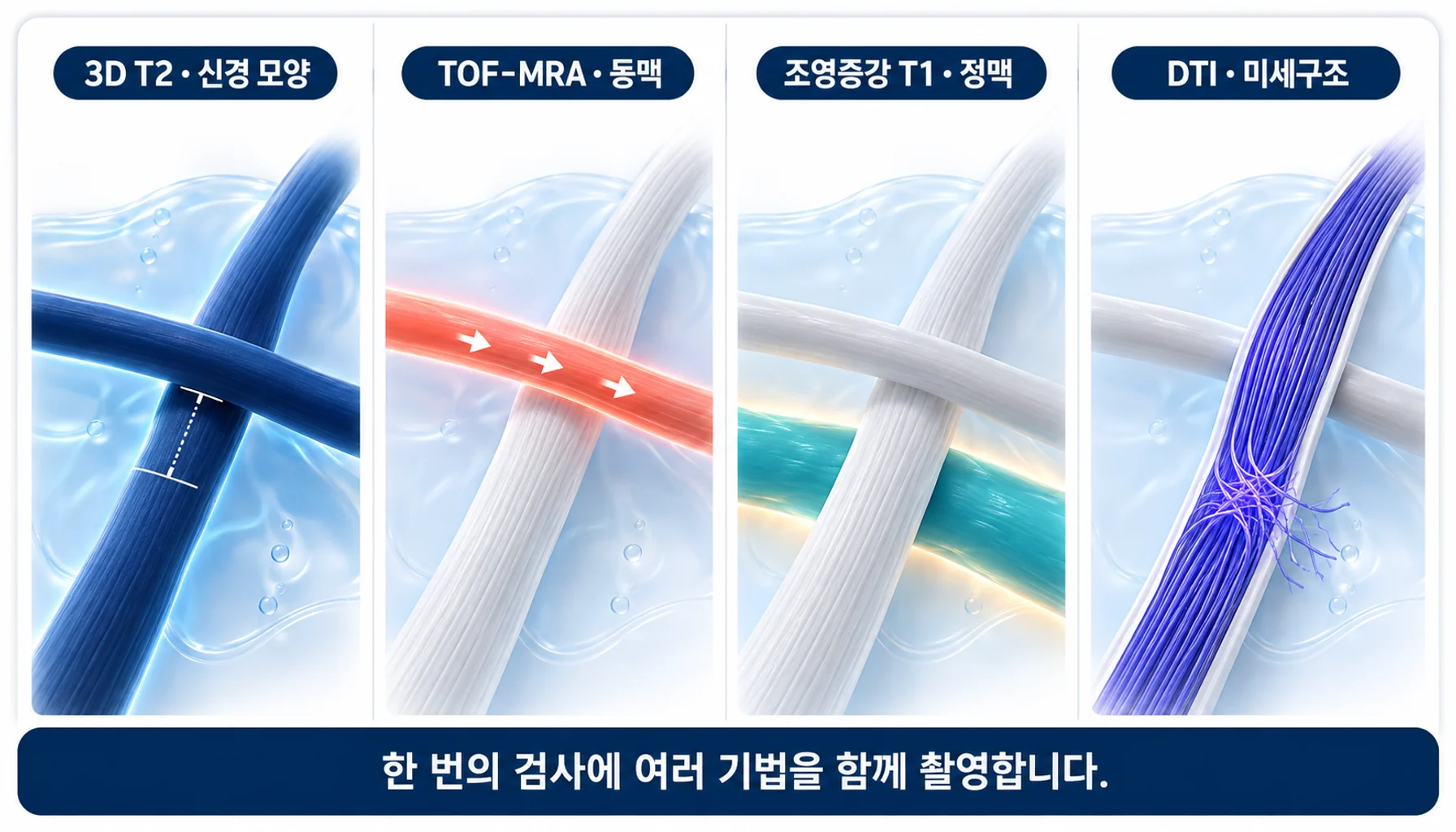 삼차신경 주변 구조와 3D T2·TOF-MRA·조영증강 T1·DTI가 각각 보여 주는 대상을 비교한 그림