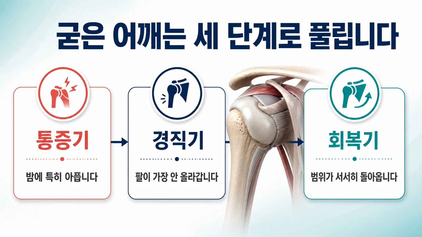동결견의 통증기·경직기·회복기 세 단계와 단계별 관리 방향을 나타낸 안내 이미지