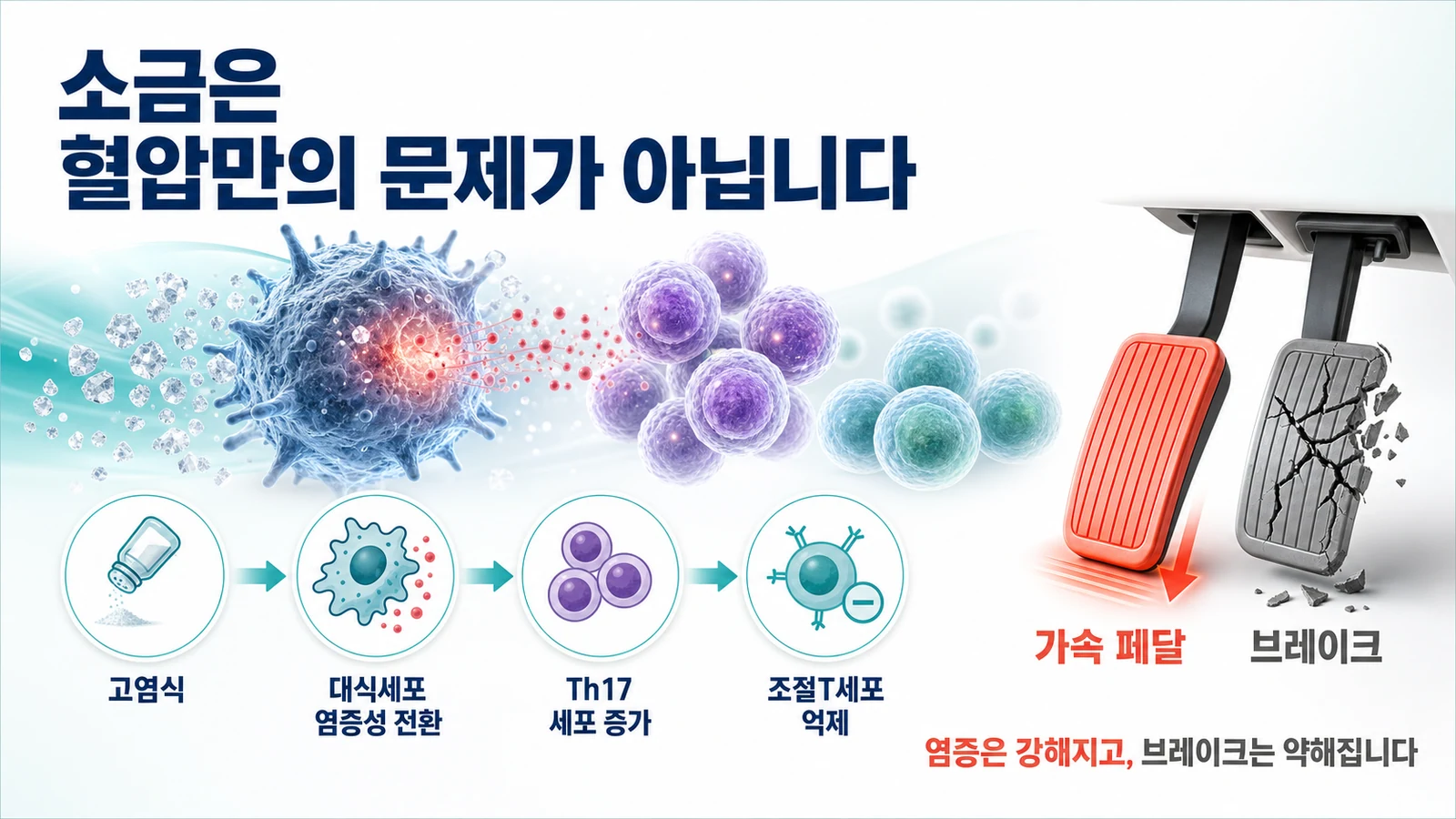 고염식이 면역세포를 자극하는 기전 — 대식세포 염증성 전환, Th17 증가, 조절T세포 억제