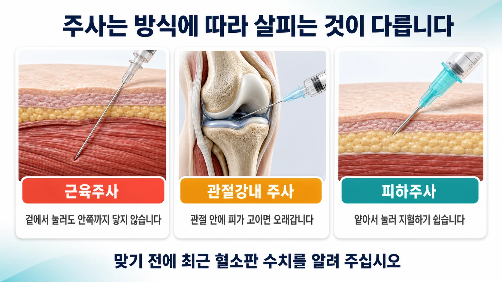 주사 방식에 따라 살피는 것이 다릅니다