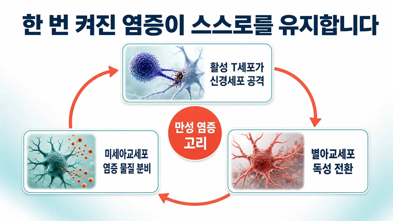 활성화된 교세포가 만성 염증 고리를 만들어 신경 손상을 이어가는 과정을 나타낸 도식