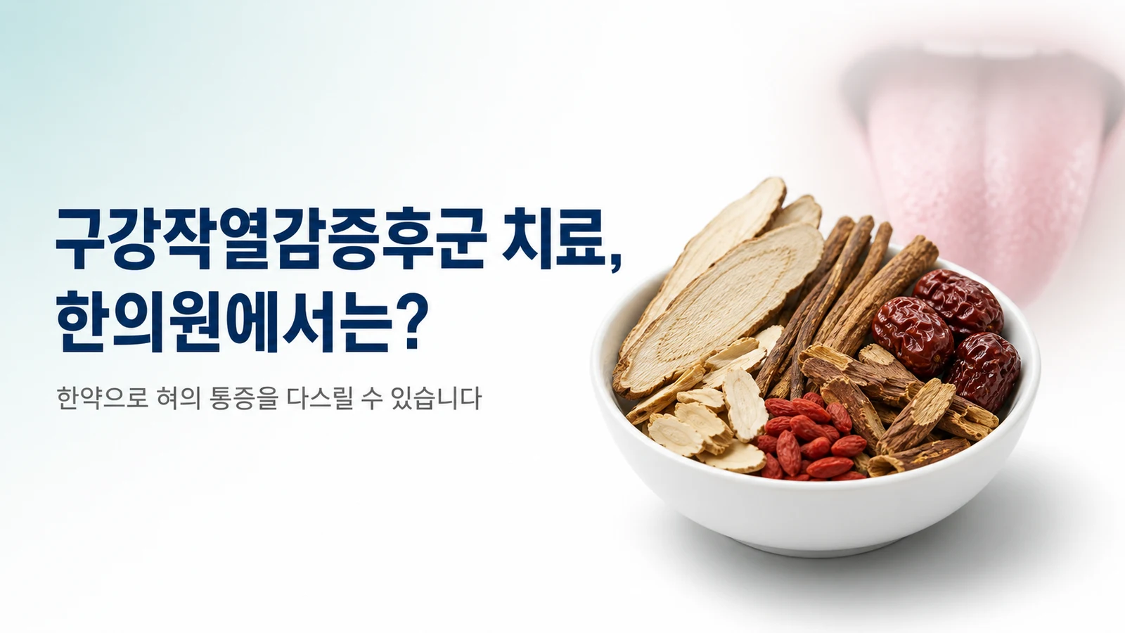 구강작열감증후군 치료, 한의원에서는 무엇을 하나요 — 한약 치료와 완치