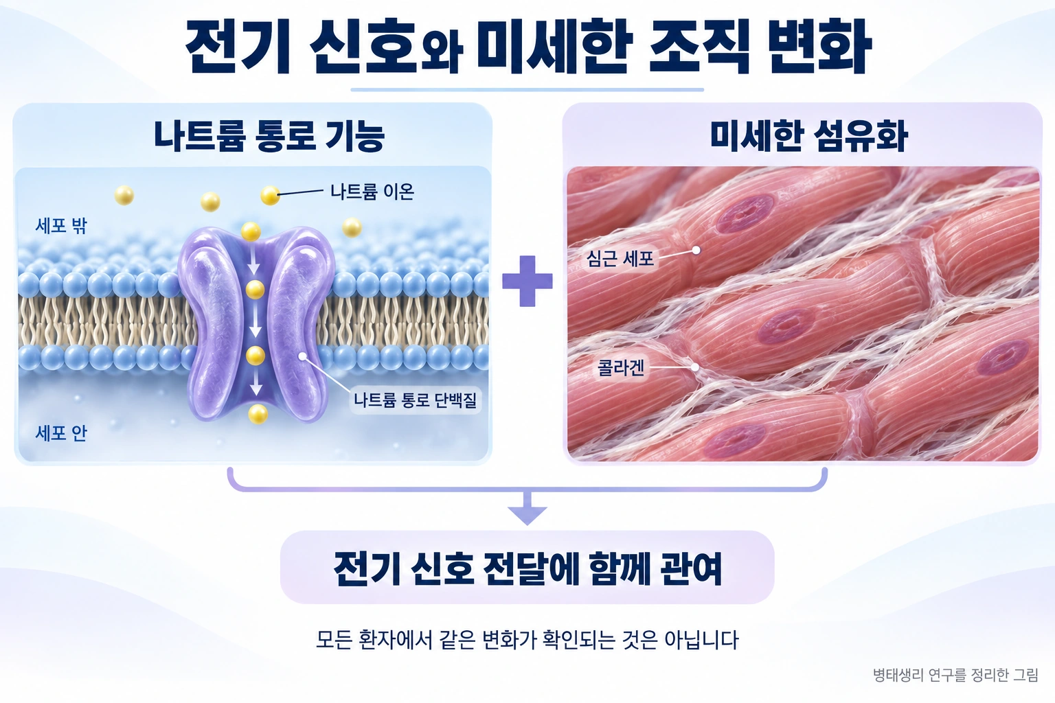 나트륨 통로 기능과 심장 근육의 미세한 섬유화가 전기 신호 전달에 함께 관여할 수 있음을 설명합니다.