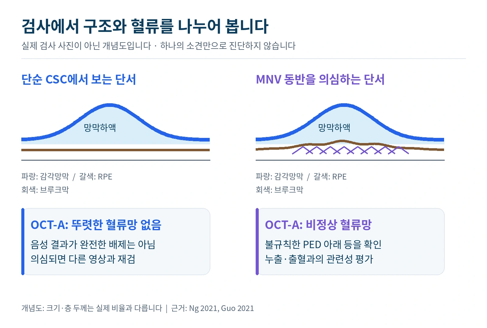CSC와 신생혈관 동반 CSC에서 확인하는 OCT 구조와 OCT-A 혈류 신호의 개념도