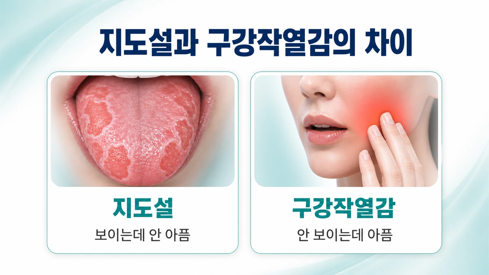 지도설과 구강작열감의 차이