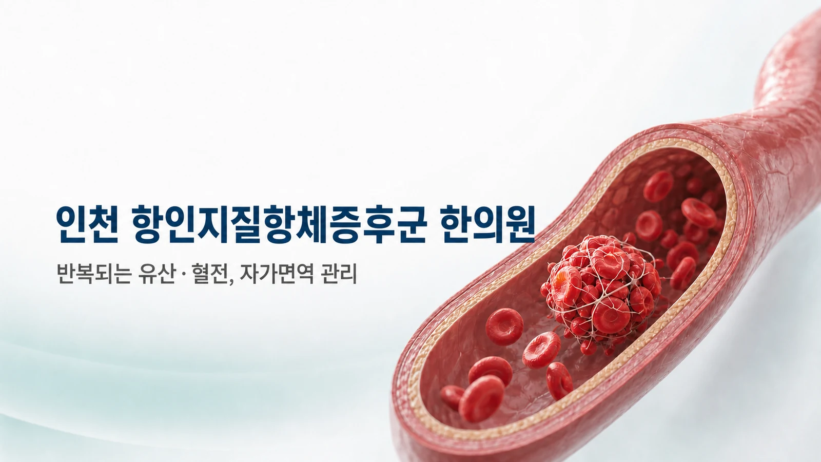 항인지질항체증후군 — 반복되는 유산·혈전, 자가면역 관리