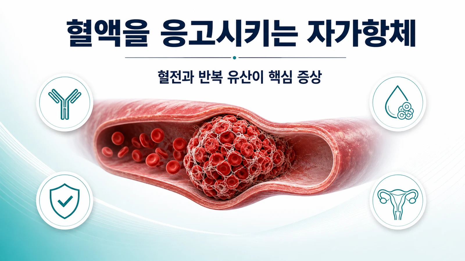 반복되는 유산·혈전, 자가면역 관리