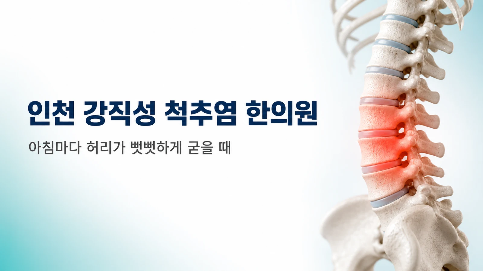 강직성 척추염 — 아침마다 허리가 뻣뻣하게 굳을 때
