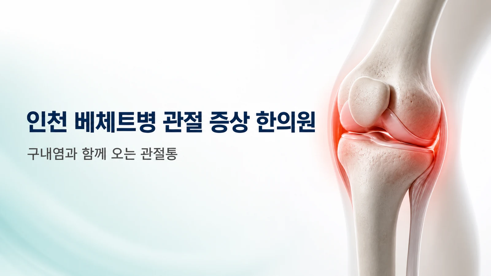 베체트병 관절 증상 — 구내염과 함께 오는 관절통