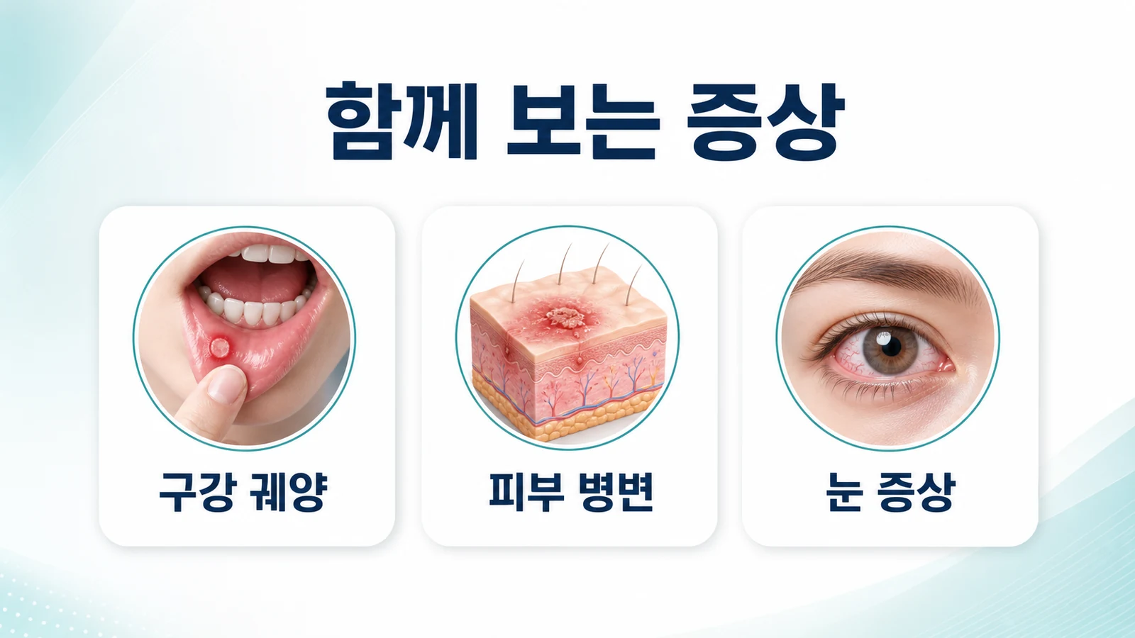 구내염과 함께 오는 관절통
