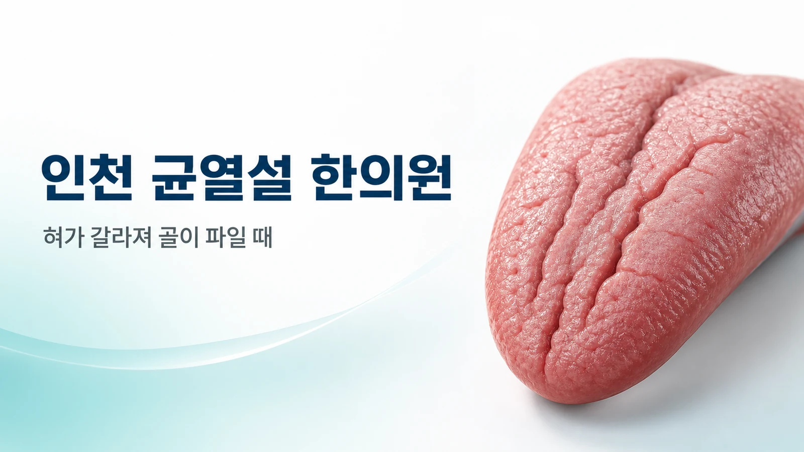 균열설 혀 갈라짐 — 골이 파일 때 치료가 필요한 경우