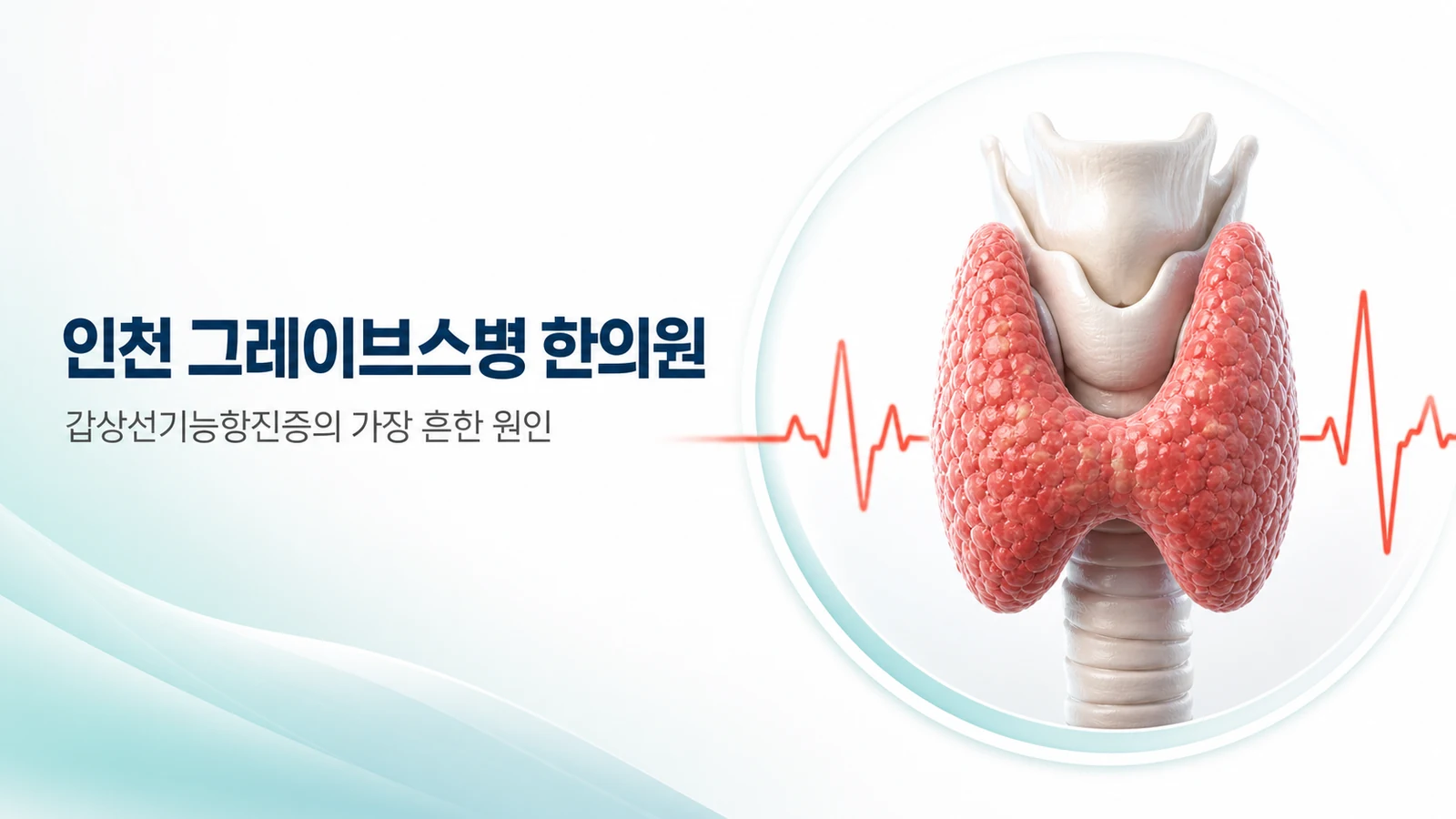 그레이브스병 — 갑상선기능항진증의 가장 흔한 원인