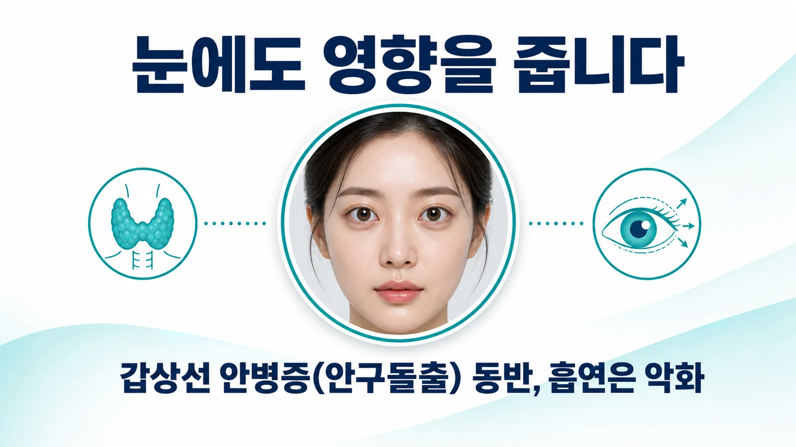갑상선기능항진증의 가장 흔한 원인
