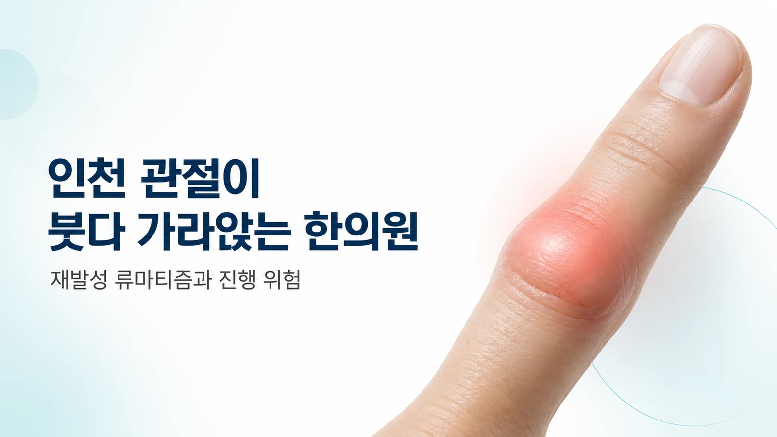 관절이 붓다 가라앉는 — 재발성 류마티즘과 진행 위험
