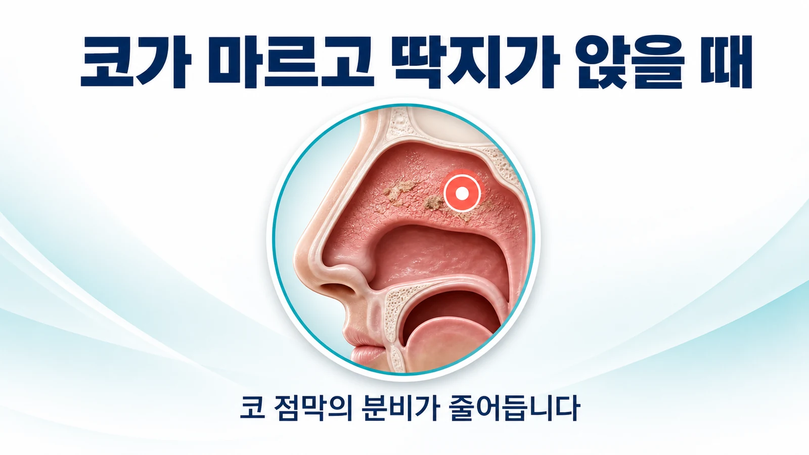코가 마르고 딱지가 앉을 때