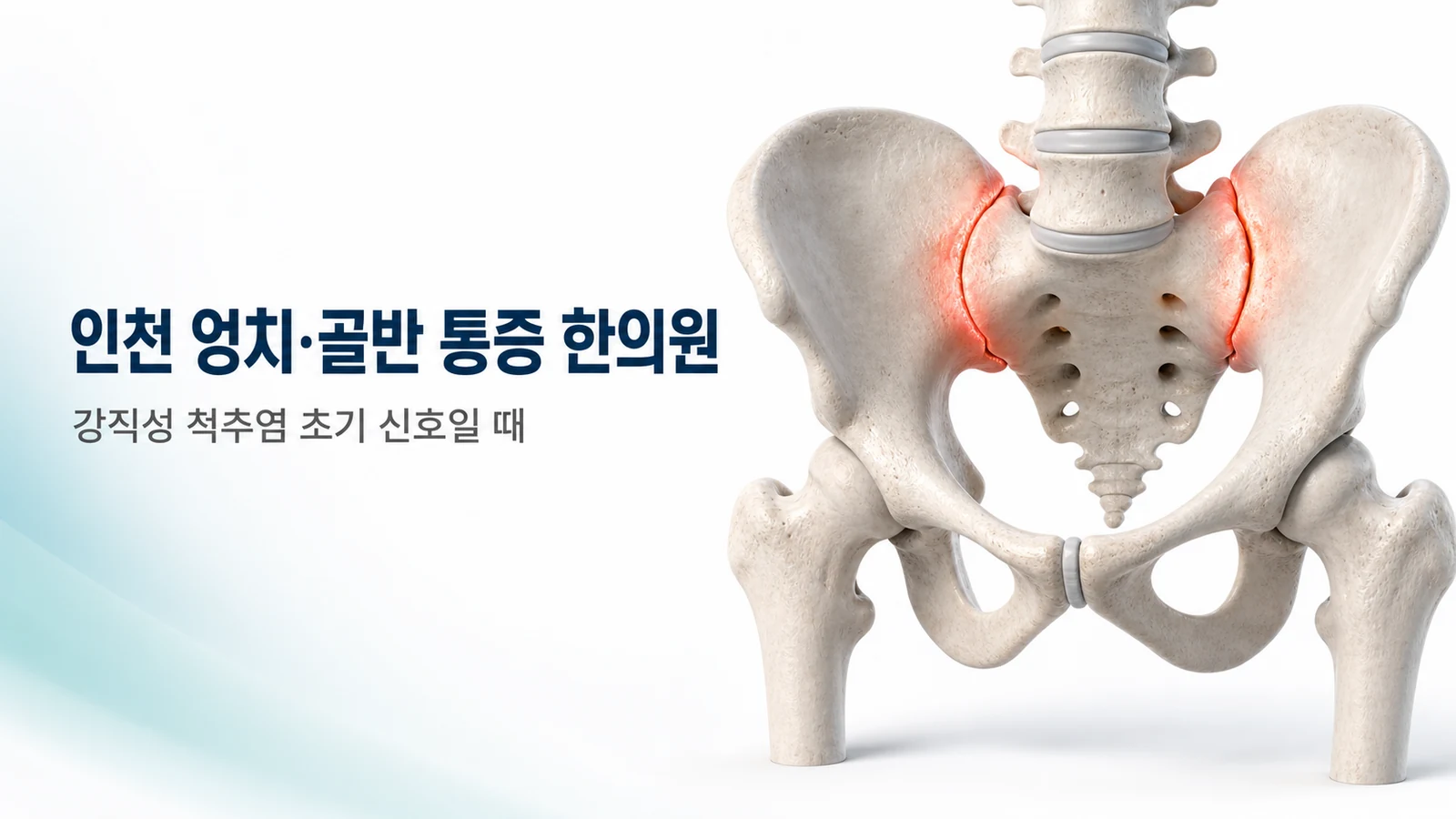 엉치 골반 통증 — 강직성 척추염 초기 신호일 때