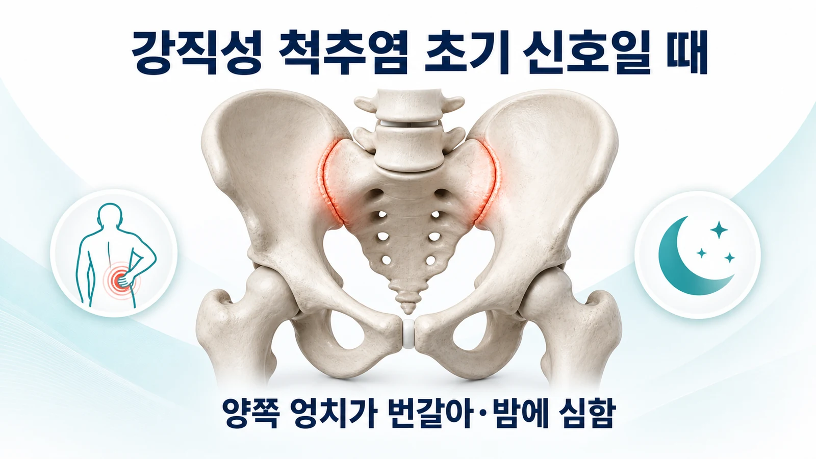 강직성 척추염 초기 신호일 때