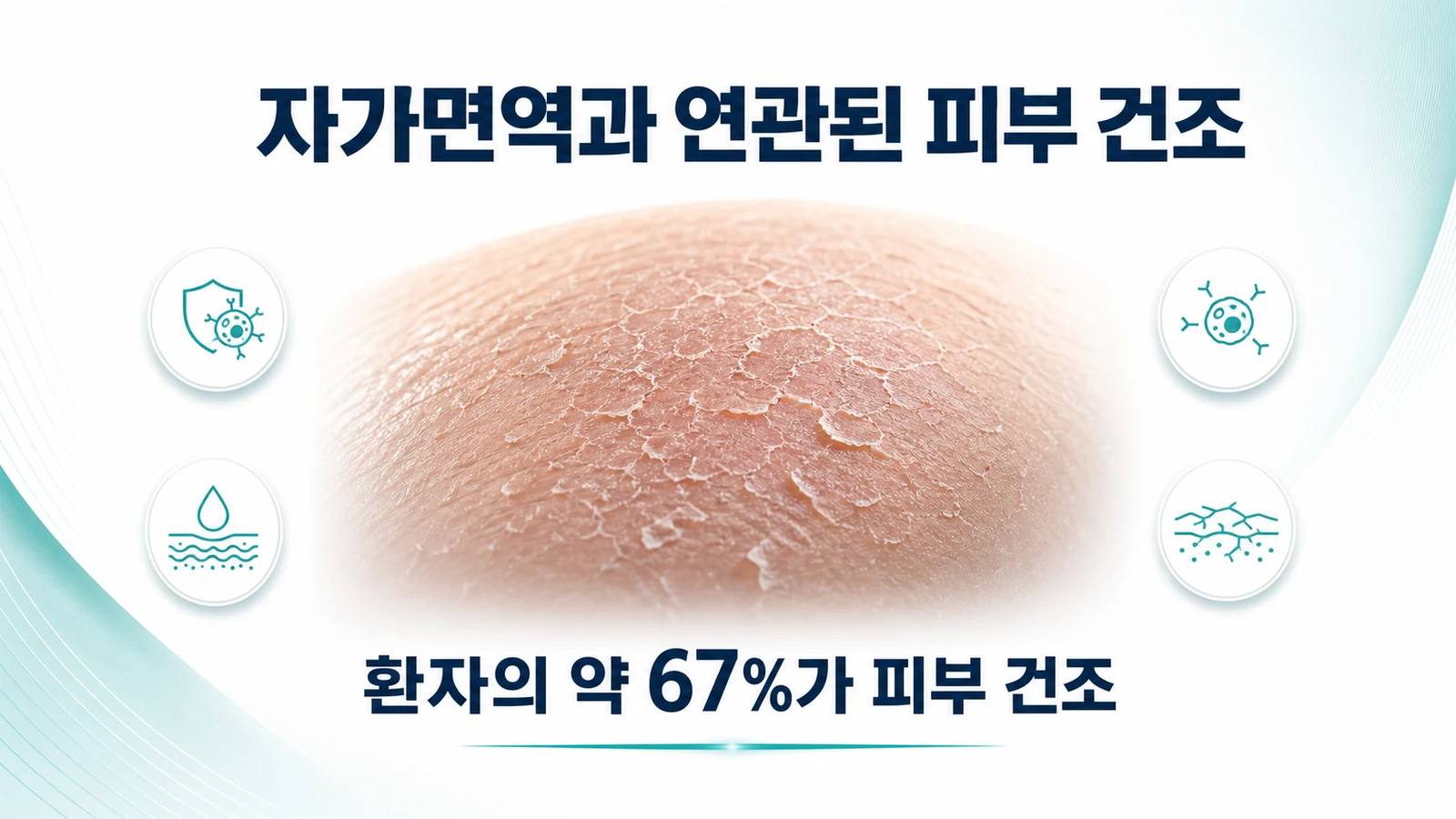 자가면역과 연관된 피부 건조
