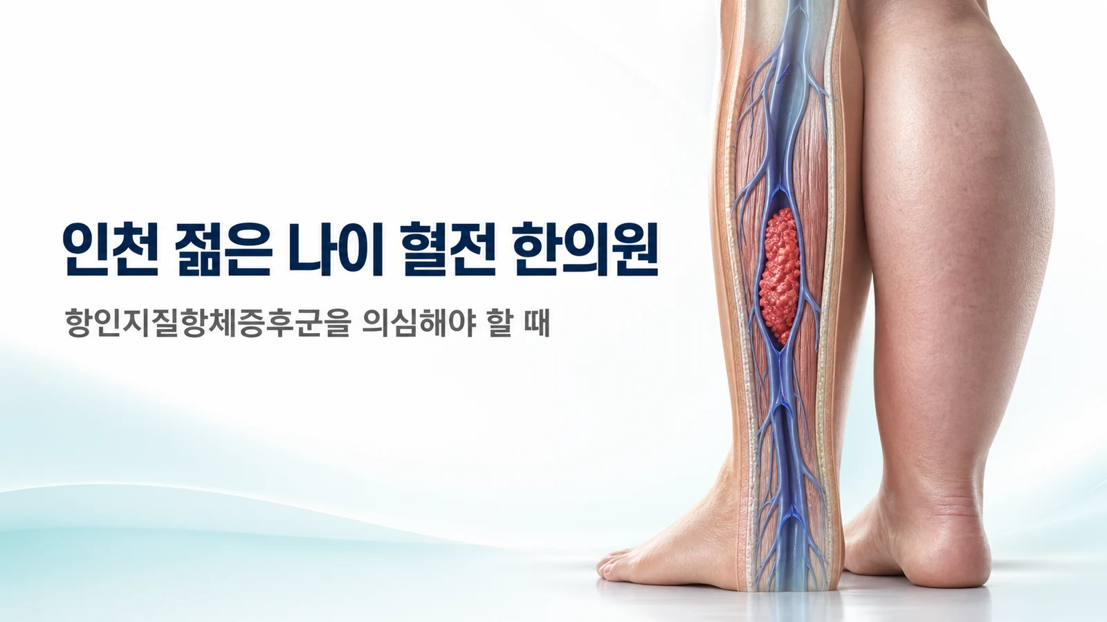 젊은 나이 혈전 — 항인지질항체증후군을 의심해야 할 때