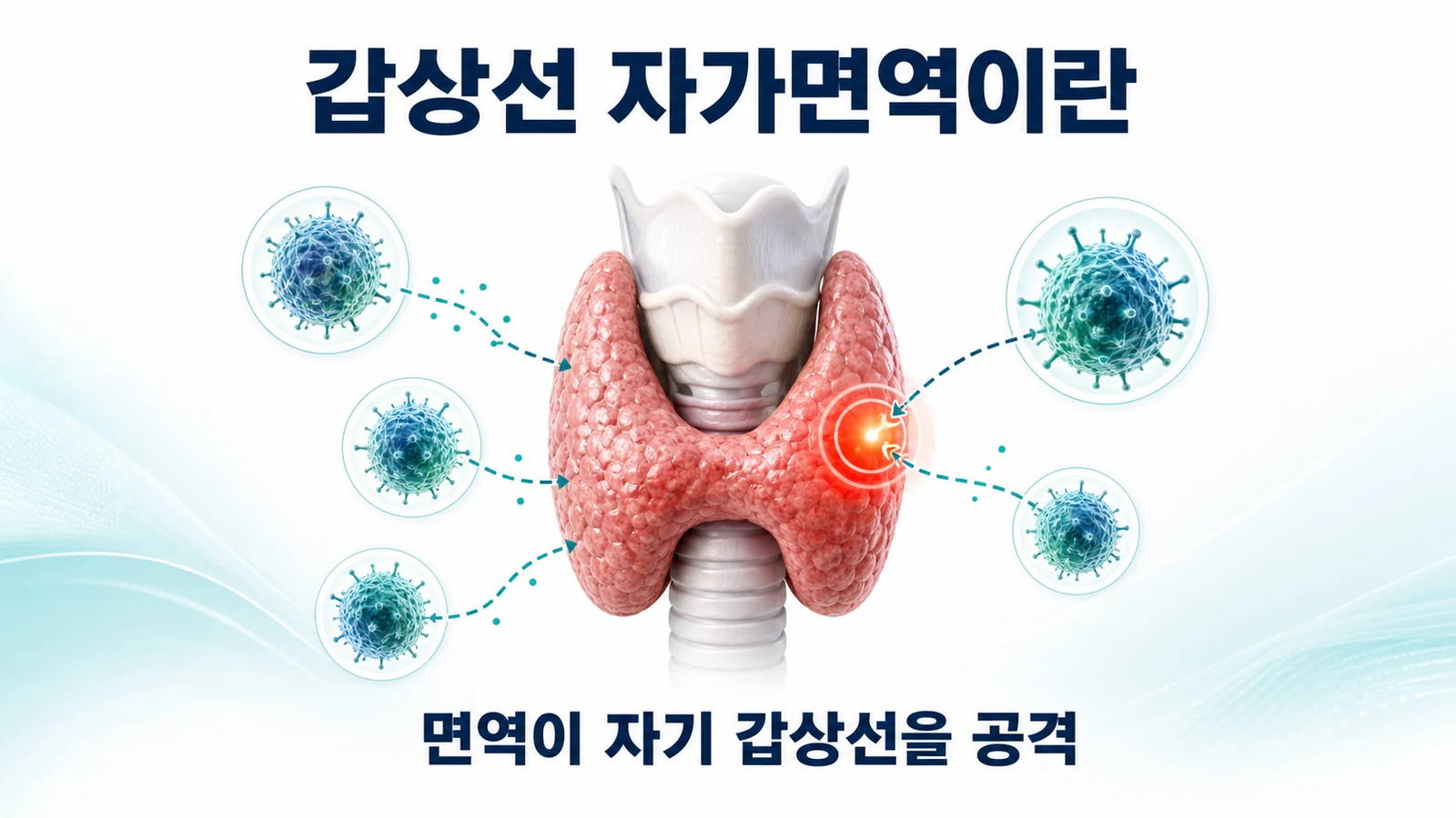 갑상선 자가면역이란
