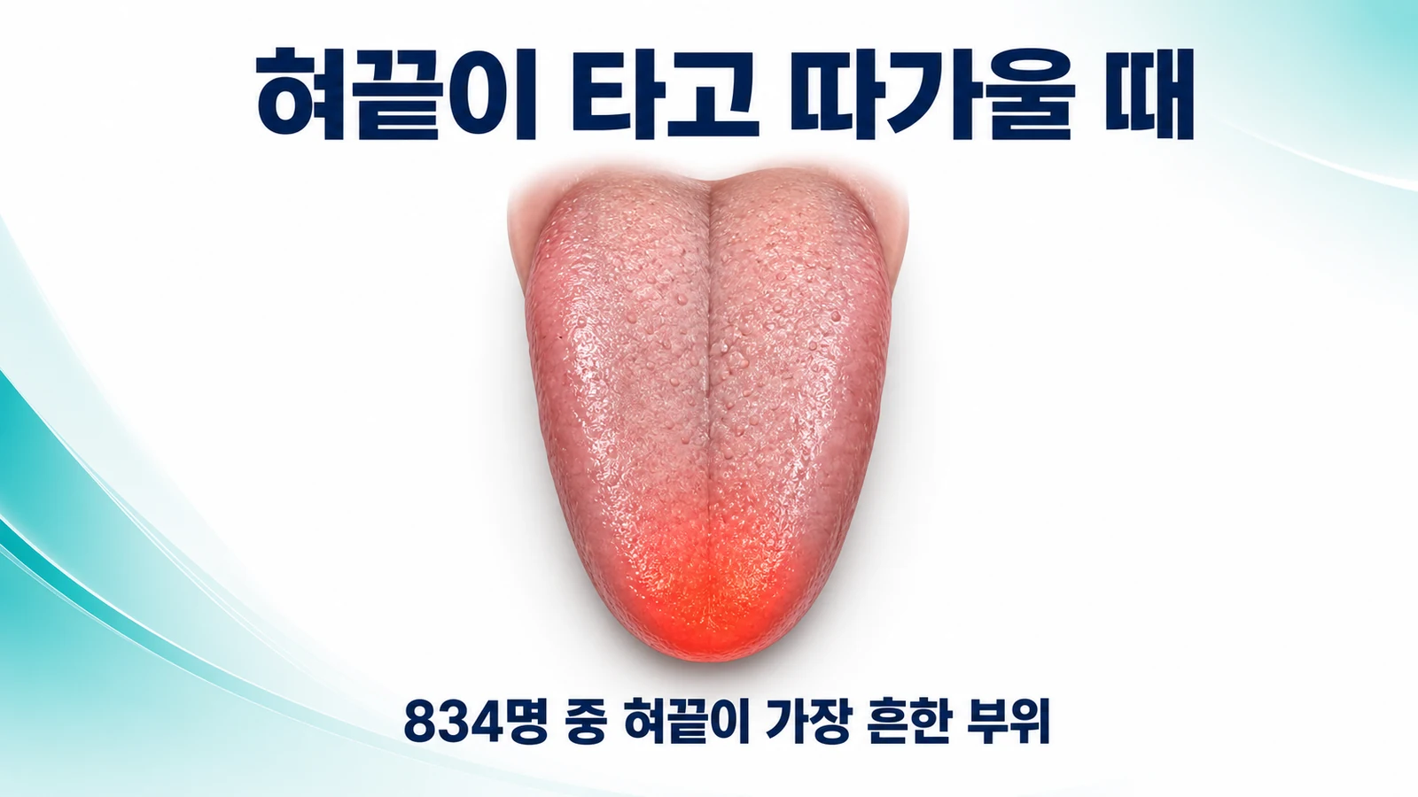 혀끝이 타고 따가울 때