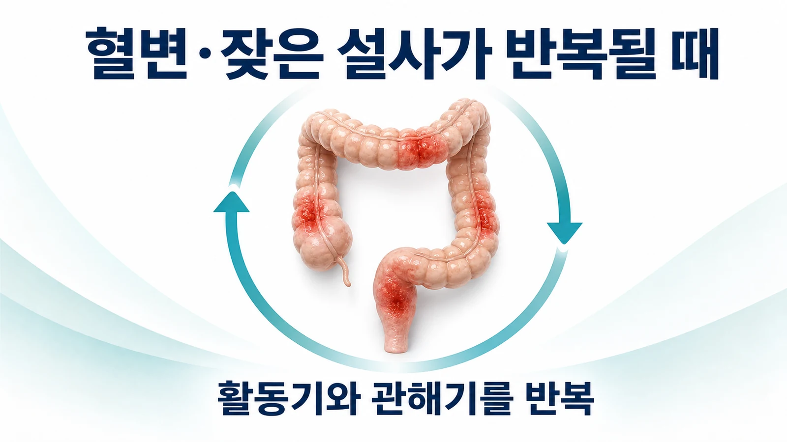 혈변·잦은 설사가 반복될 때