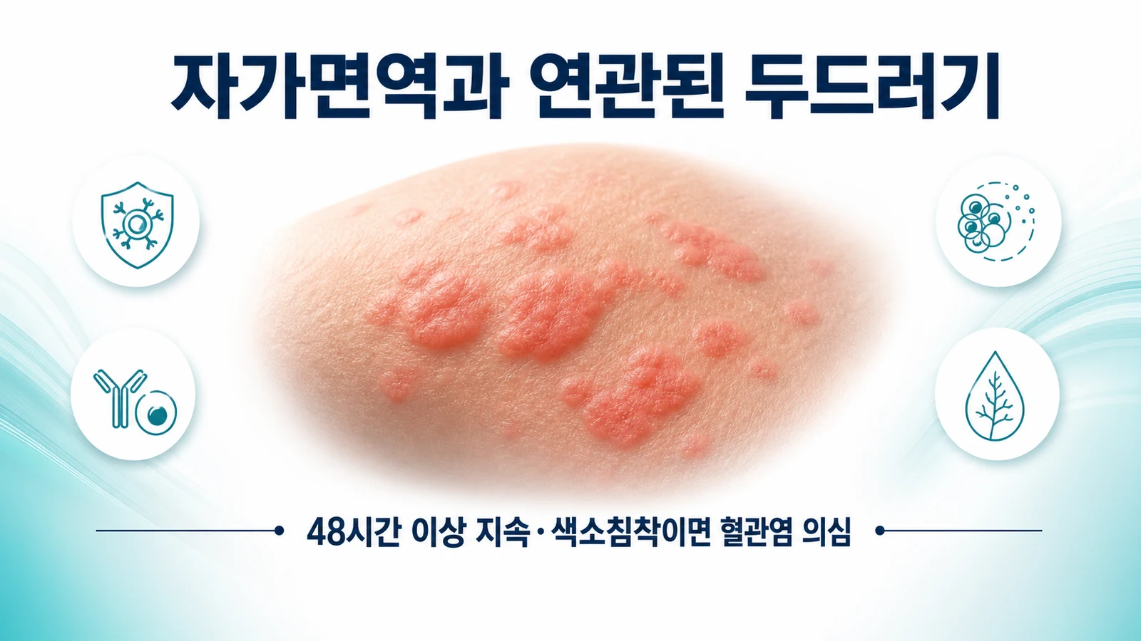자가면역과 연관된 두드러기