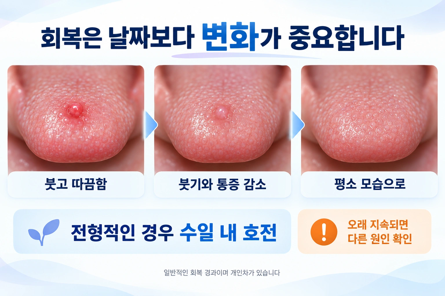 부어오른 유두의 붓기와 통증이 줄고 평소 모습으로 돌아가는 일반적인 회복 과정을 보여줍니다.