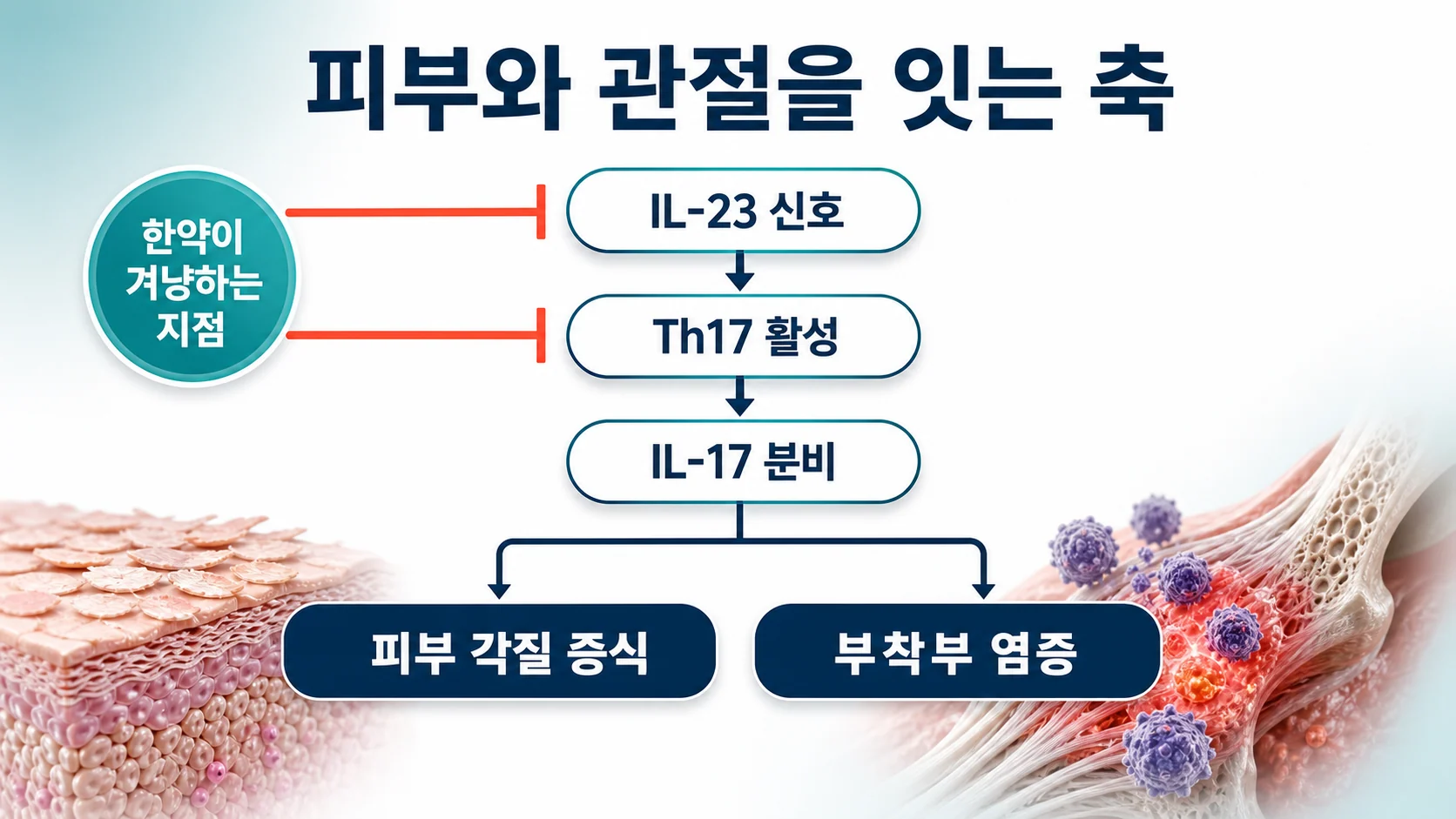 IL-23과 IL-17 축이 피부와 관절로 갈라지는 경로를 정리한 도식