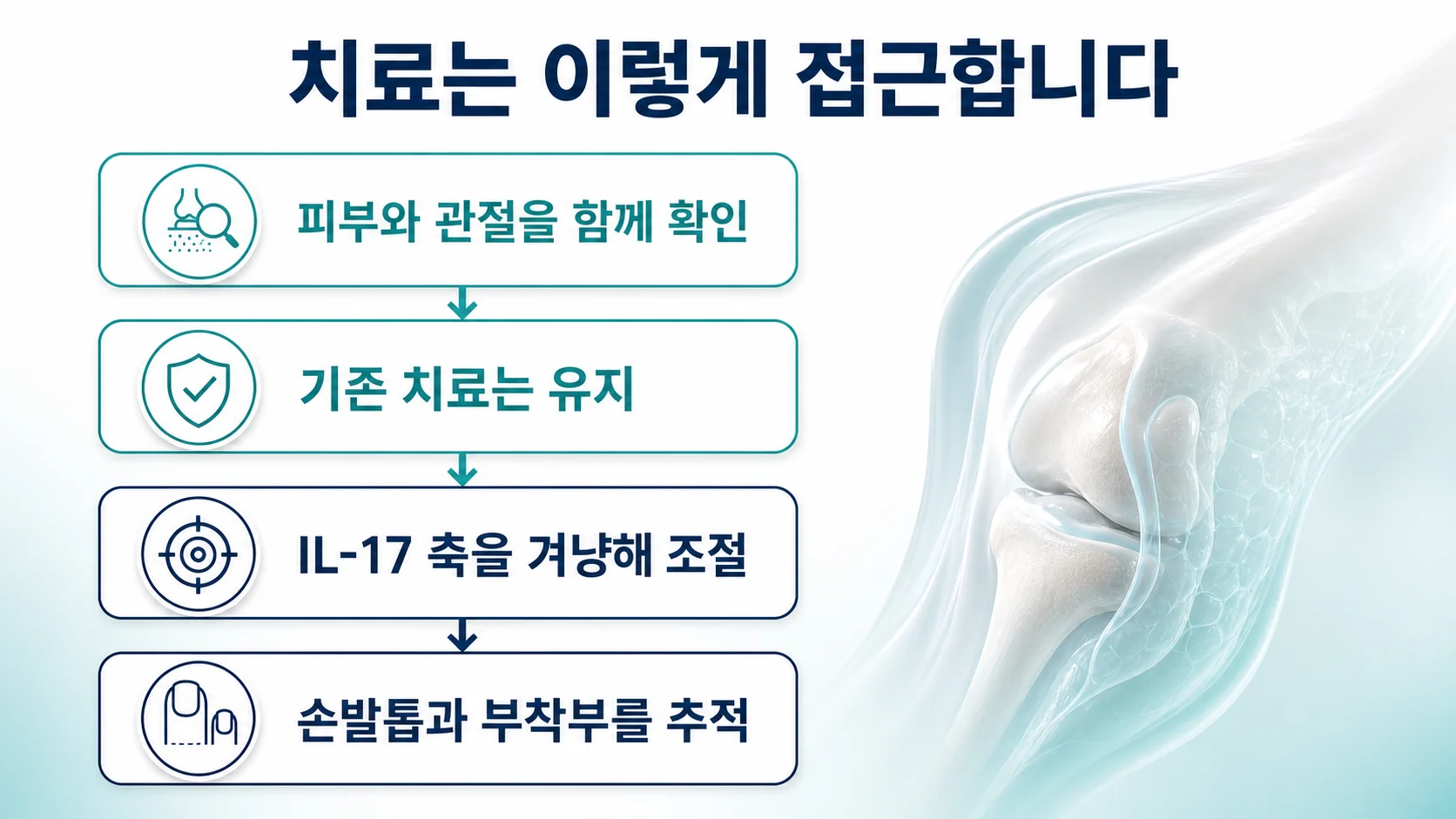 치료 접근의 네 단계를 정리한 이미지