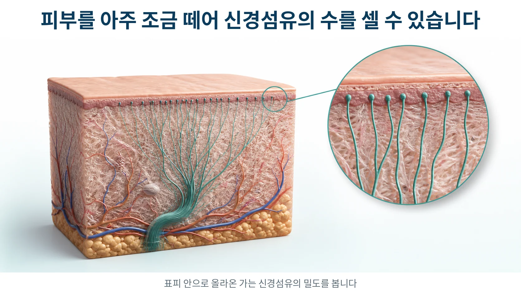 피부를 세로로 잘라 표피와 진피를 보여 주고 진피에서 표피로 올라간 가느다란 신경섬유를 확대한 그림