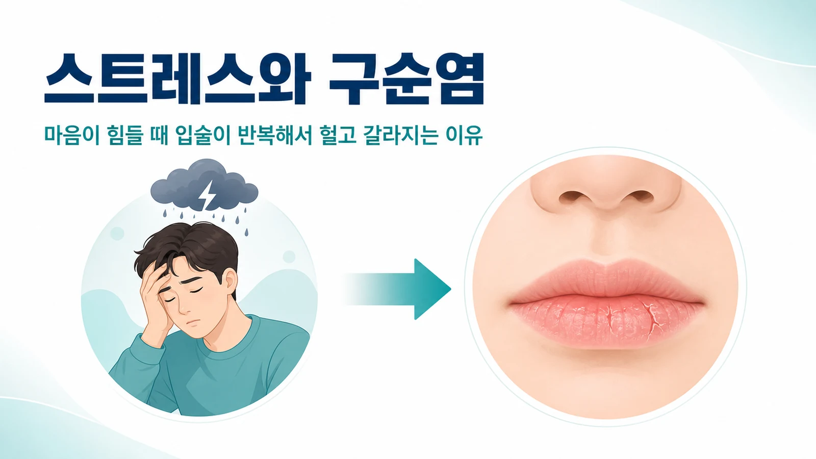 스트레스를 받을 때 입술이 반복해서 헐고 갈라지는 관계를 나타낸 대표 그림