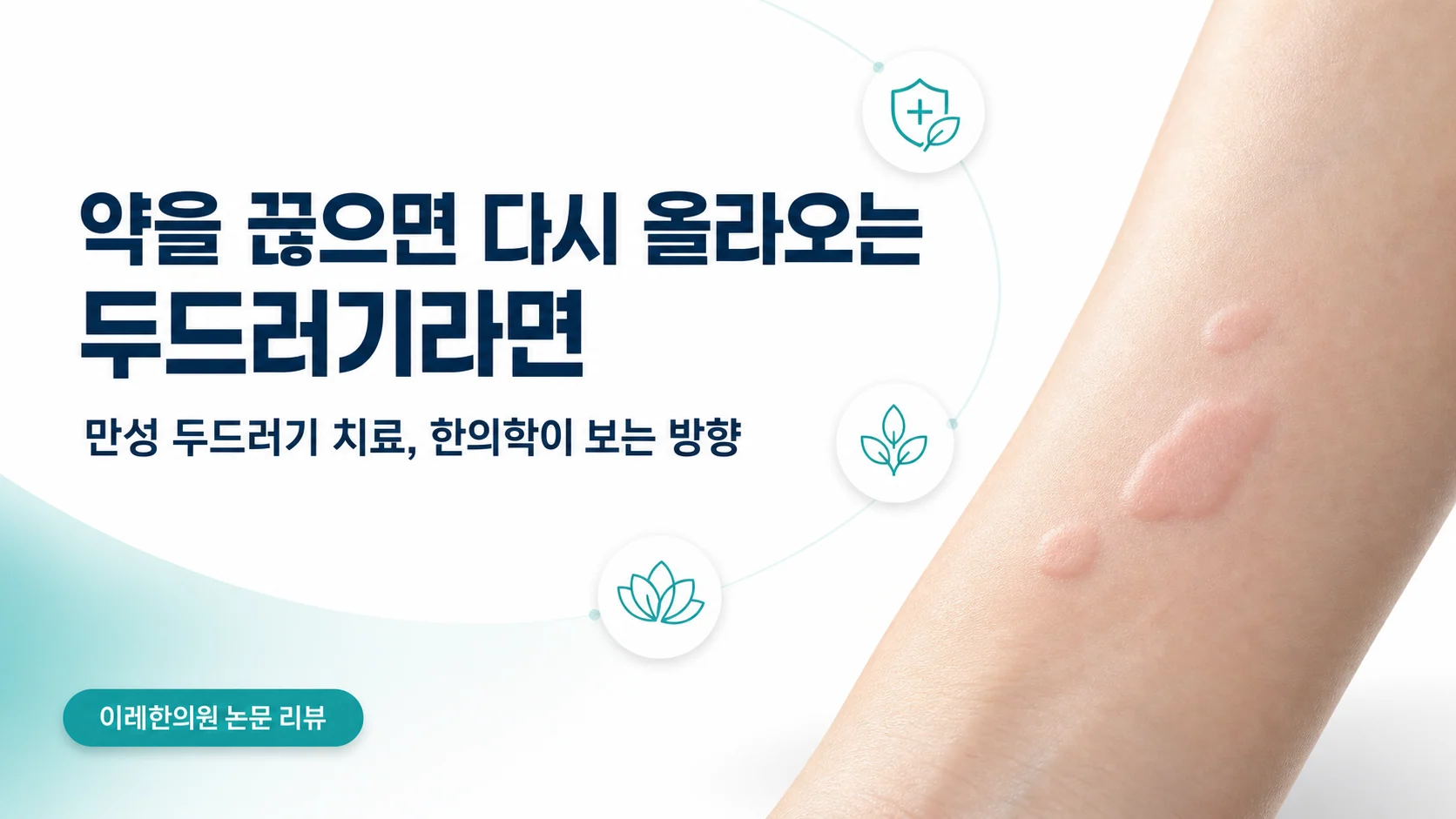 약을 끊으면 다시 올라오는 만성 두드러기를 다루는 글의 표지 이미지