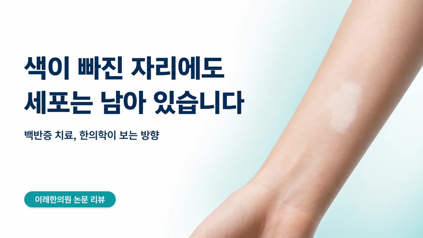 색이 빠진 자리에도 세포는 남아 있다는 주제의 백반증 글 표지 이미지