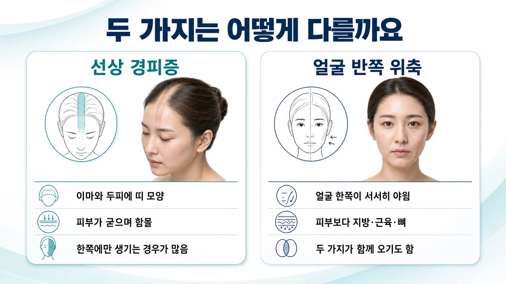 선상 경피증과 얼굴 반쪽 위축을 비교한 도식