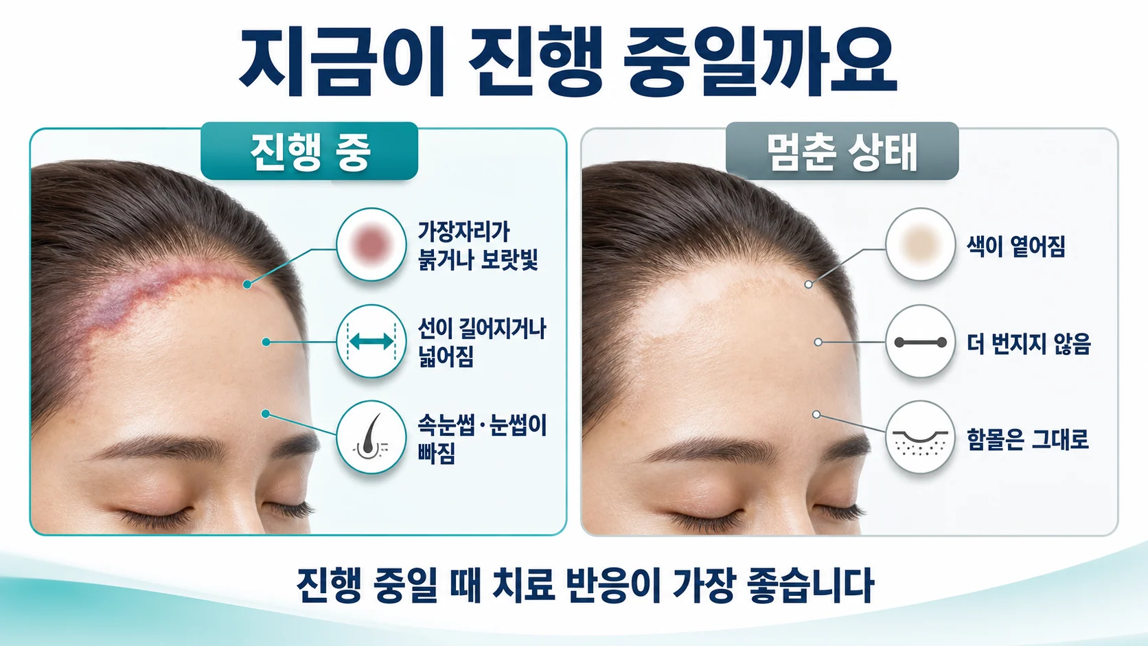 진행 중인 상태와 멈춘 상태를 비교한 도식