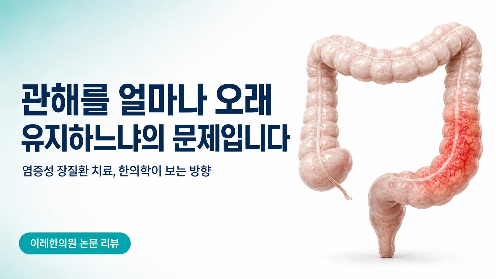 관해를 얼마나 오래 유지하느냐가 관건인 염증성 장질환 글의 표지 이미지