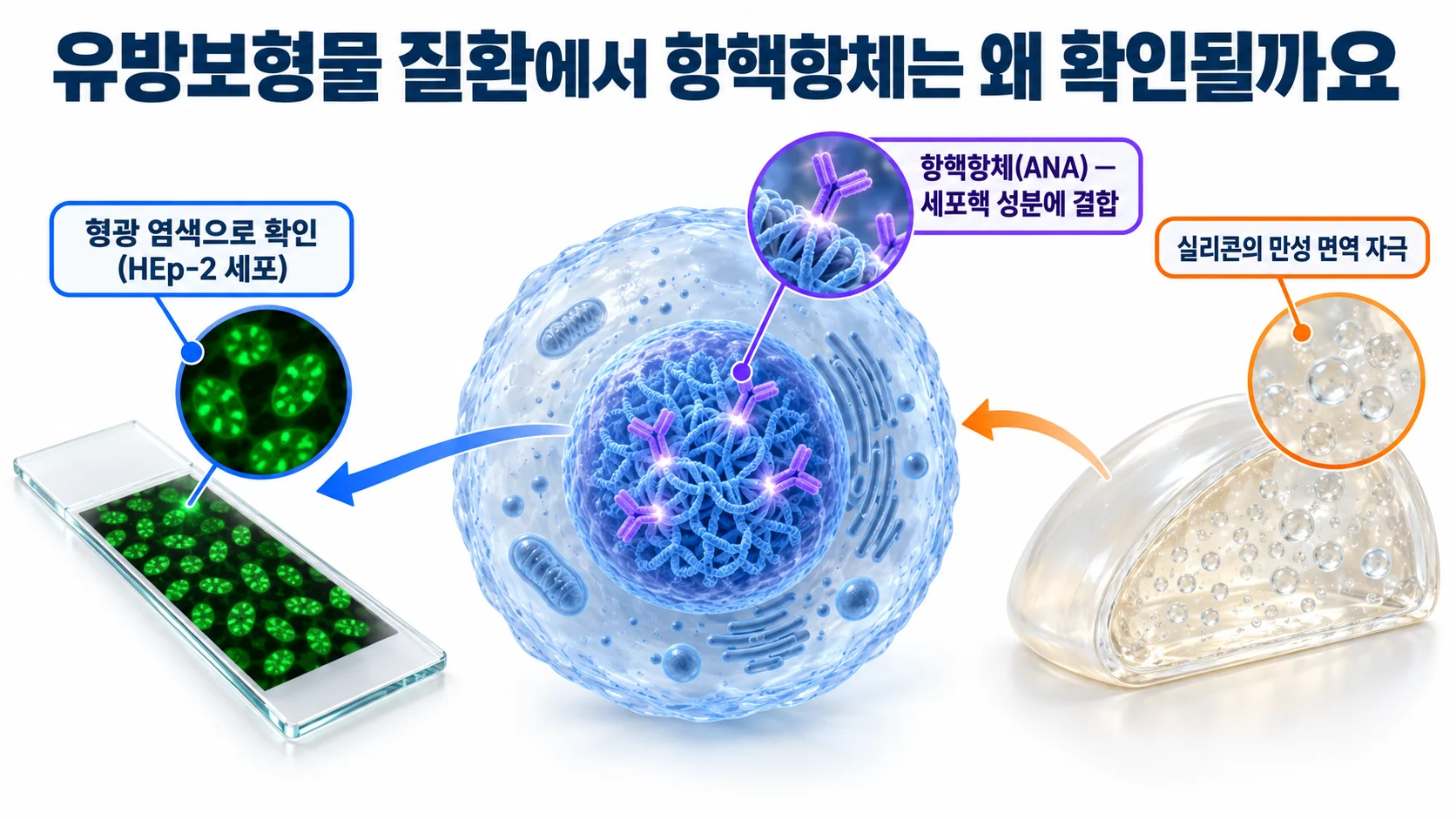 세포핵 성분에 결합한 항핵항체와 형광 염색 슬라이드, 실리콘 보형물을 연결한 모식도