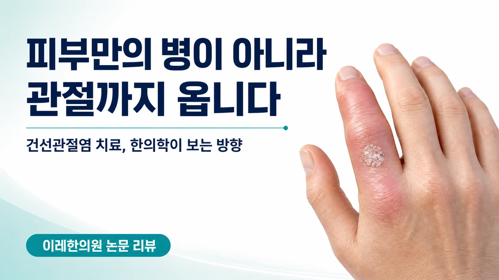 건선관절염 — 피부만의 병이 아니라 관절까지 옵니다