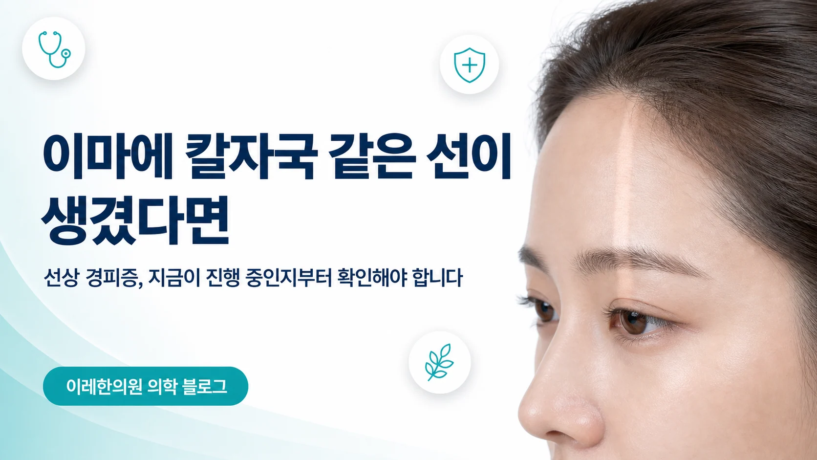 선상 경피증(en coup de sabre) — 이마에 칼자국 같은 선이 생겼다면