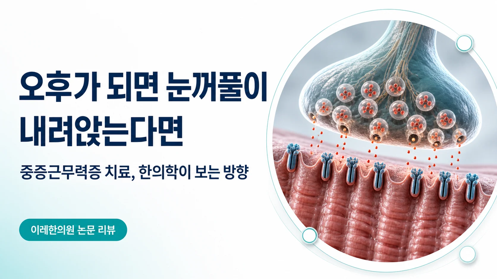중증근무력증 — 오후가 되면 눈꺼풀이 내려앉는다면